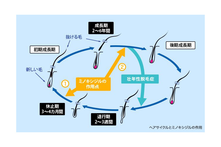 ミノキシジル外用の効果